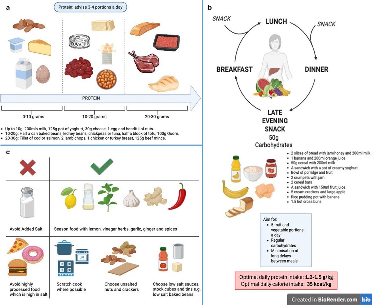 IHepatology's tweet photo. Very pleased to see out this practical guide to #nutrition in #cirrhosis in @FrontGastro_BMJ: https://t.co/wKR5oTYEXU.  Thanks to @lukelikeslivers, @salihacooks, and the rest of the team! https://t.co/8b2VpSPzpf