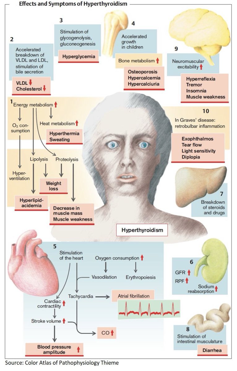 ✅أول شي لازم تسويه فورًا هو إيقاف دواء Methimazole وطلب CBC (complete blood count) عاجل، لأن هالأعراض (حرارة و احتقان حلق) ممكن تكون أول علامة على Agranulocytosis، و هي من أخطر المضاعفات النادرة بس الخطيرة لدواء Methimazole أو Propylthiouracil. السبب إن الدواء ممكن يسبب bone