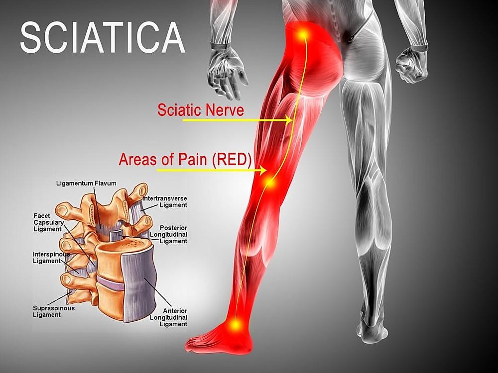 Freehold Pain Relief tweet media