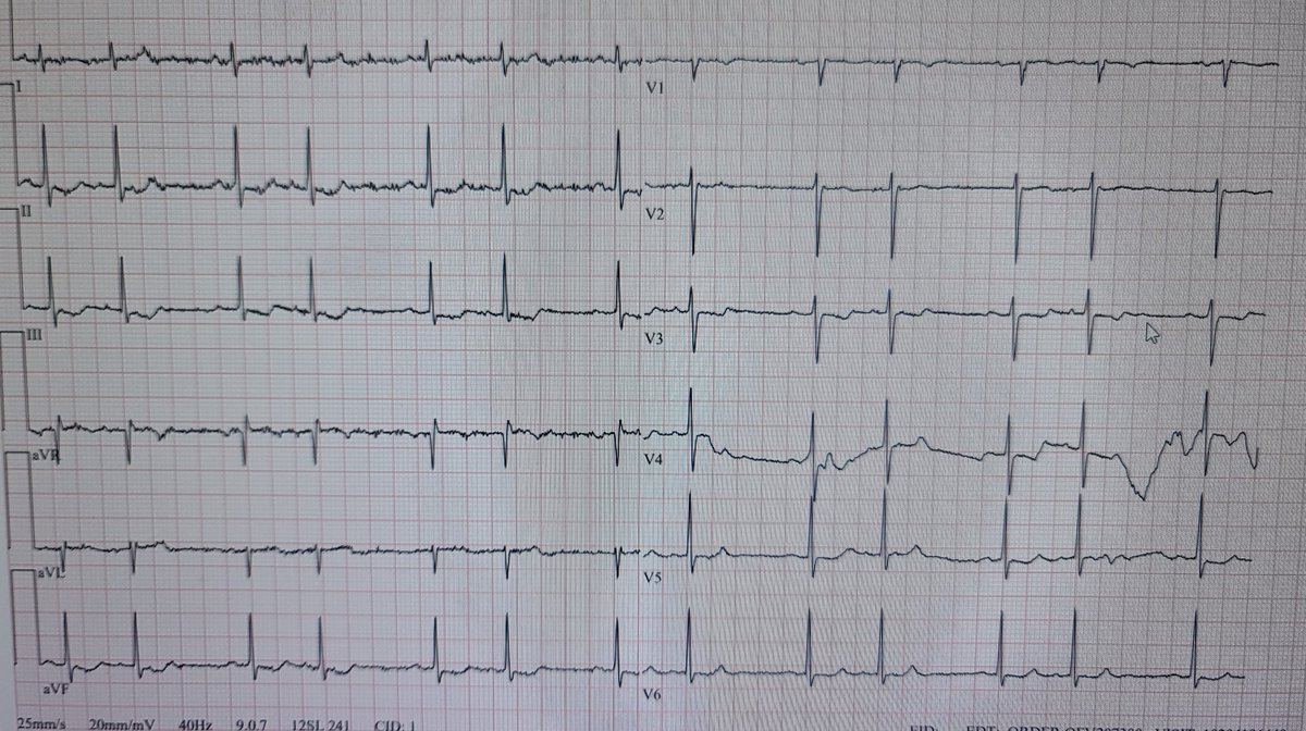ECG Challenge tweet media