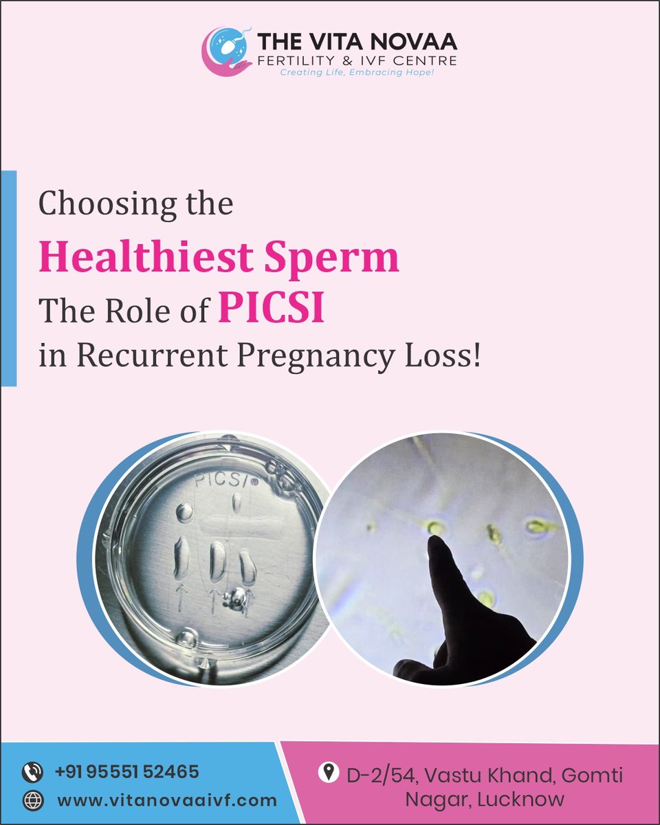 dr_kritisingh's tweet photo. Choosing the healthiest sperm for a healthier pregnancy! 💫
PICSI makes a difference in cases of high DFI or recurrent miscarriages.
#PICSI #MaleInfertility #DrKritiSingh https://t.co/zLj1BwyM3r