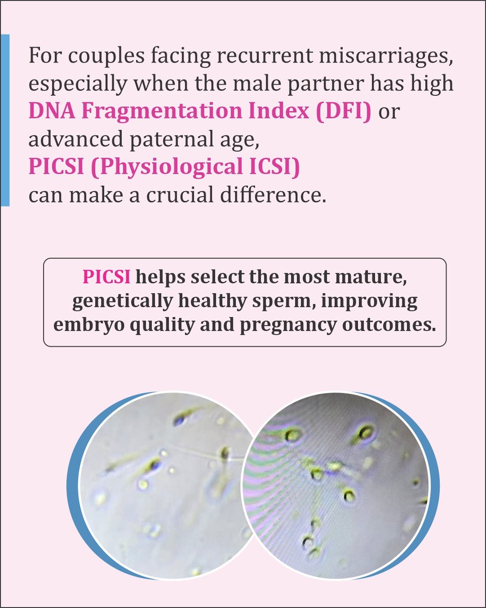 dr_kritisingh's tweet photo. Choosing the healthiest sperm for a healthier pregnancy! 💫
PICSI makes a difference in cases of high DFI or recurrent miscarriages.
#PICSI #MaleInfertility #DrKritiSingh https://t.co/zLj1BwyM3r
