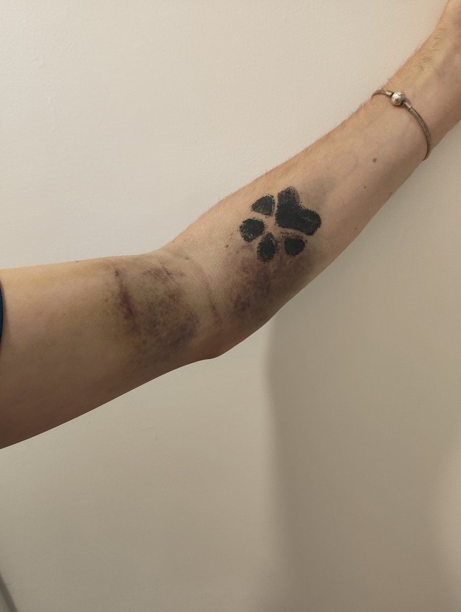 Ever wondered what it looks like when a needle moves and fills your arm with blood?