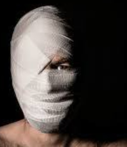 HypnoticJam's tweet photo. Will not be surprised in the slightest if they roll out Butland today looking like this https://t.co/KxwAHnblky
