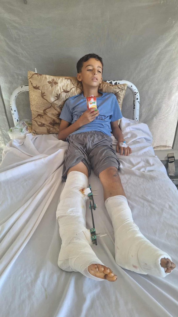 Bu çocuk, benim akrabam Muhammed Alnajjar. Terörist İsrail tarafından ağır şekilde yaralandı.

Muhammed’in Gazze dışında tedaviye ihtiyacı var.

Lütfen Muhammed’in sesi olun.