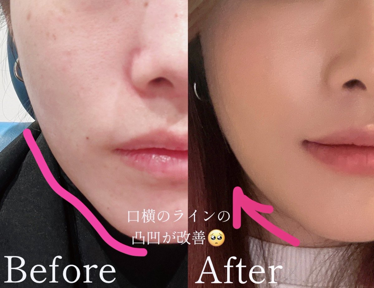 くじら🐳 【社会人in 韓国🇰🇷】 tweet media