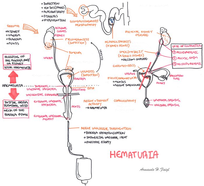 drsthanus's tweet photo. Causes and types of hematuria.

@ManualOMedicine https://t.co/n1gmdUVxLI