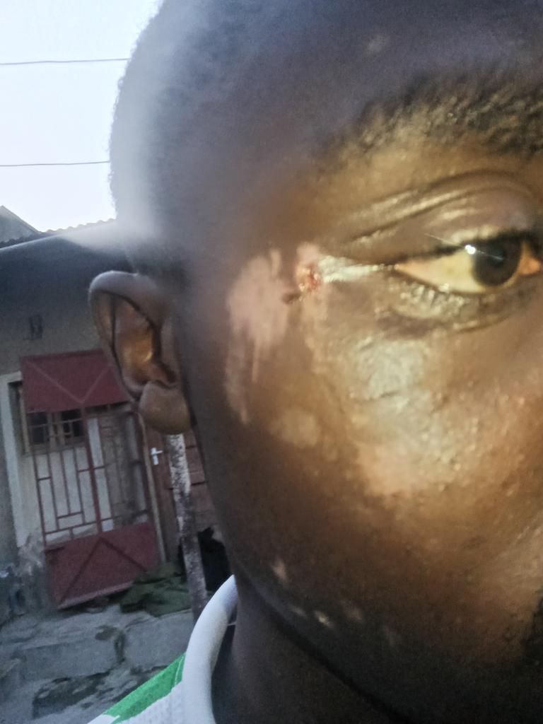 Mbeyacitycf's tweet photo. @mchiziMonie Eeh si mliambiwa nipoa mochwari...aya nitazame sasa. https://t.co/os0Idd6qIC