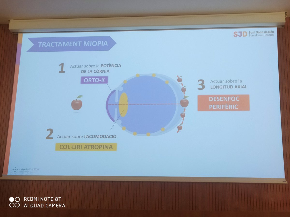 L'oftalmòloga pediàtrica Gemma Romeu ens ha actualitzat el diagnòstic, la prevenció i el tractament de la #miopia que és un problema de salut pública emergent‼️ #CursPediatriaOsona 🧐<a href="/SJDbarcelona_ca/">Hospital Sant Joan de Déu Barcelona CAT</a> <a href="/SCPed/">SCPediatria</a> <a href="/u_medicina/">Facultat de Medicina UVic-UCC</a> <a href="/Bayes_Salut/">Bayés Salut</a> #pediatria #formació #salutvisual #pantalles