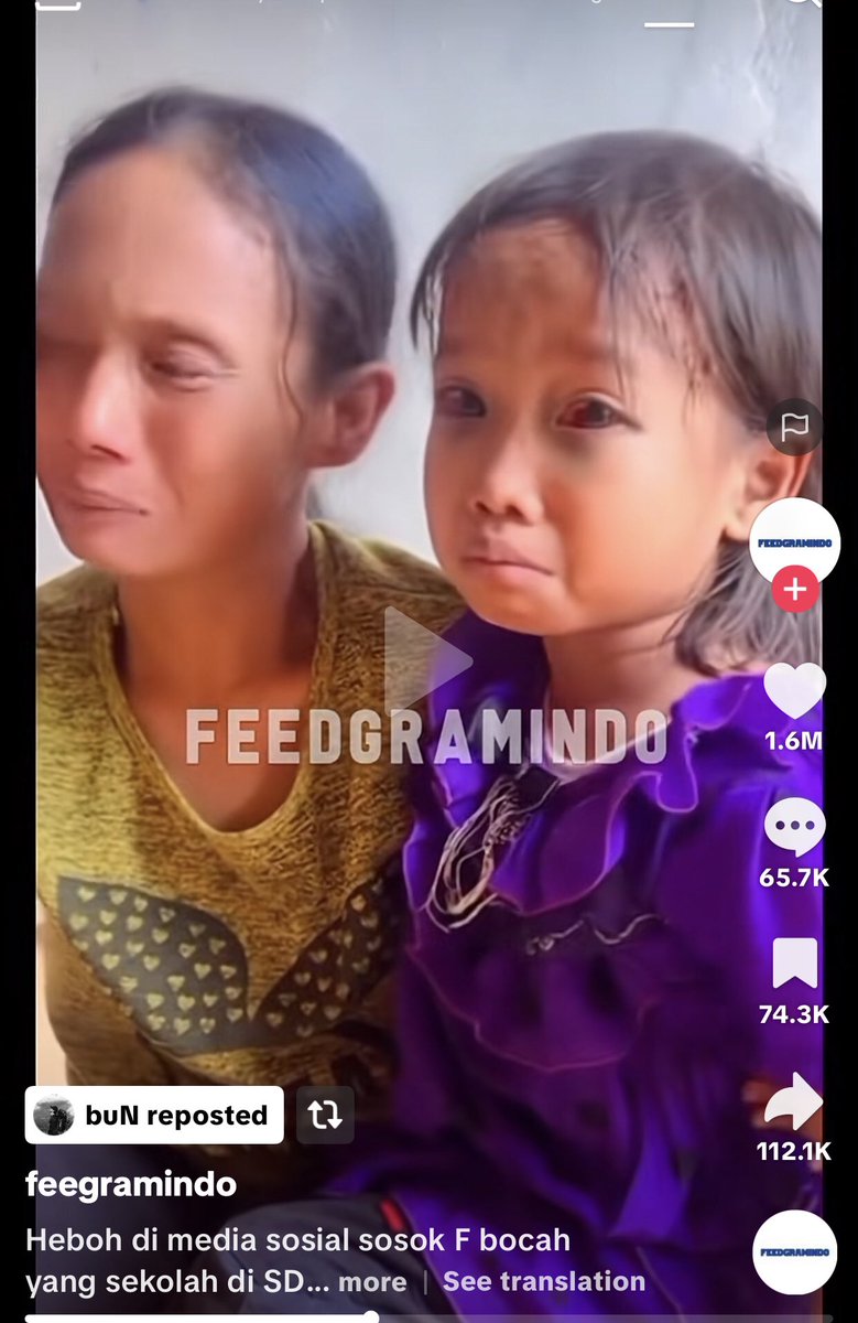 ya Allah aku liat ini ga tega banget, pertama ngeliat kondisi mata si adek, kedua liat ibunya 🥺🥺😭😭