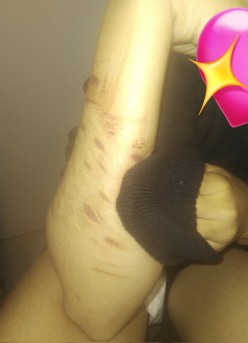 elys1fx's tweet photo. my friend hit a vein in the toilets w me AND IM FREAKINGOUT
@alyssaluvsu1528 https://t.co/tw2k0KYeX2