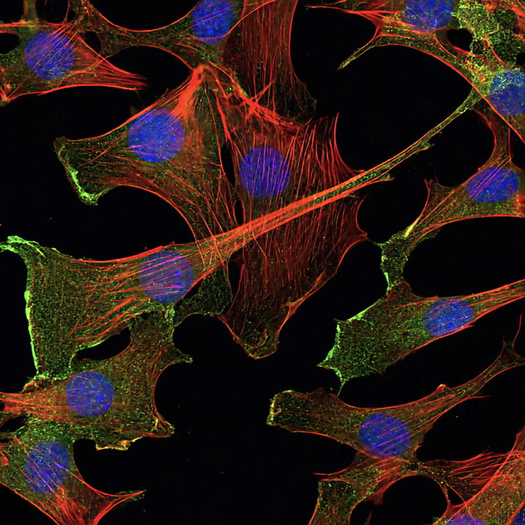 CellSignal's tweet image. With 🌟 over 48,000 citations 🌟 our Akt antibodies are trusted by researchers worldwide to study cellular functions including metabolism, growth, proliferation, survival, transcription, and protein synthesis.

hubs.ly/Q03LbnX80