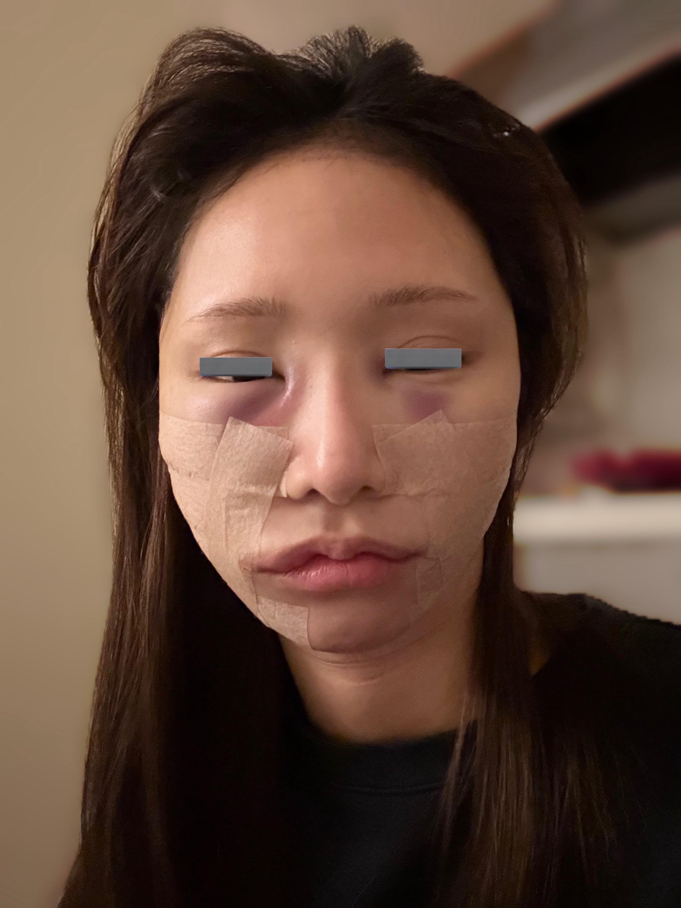 きゅ整形垢 整形垢のリアル - Search / X