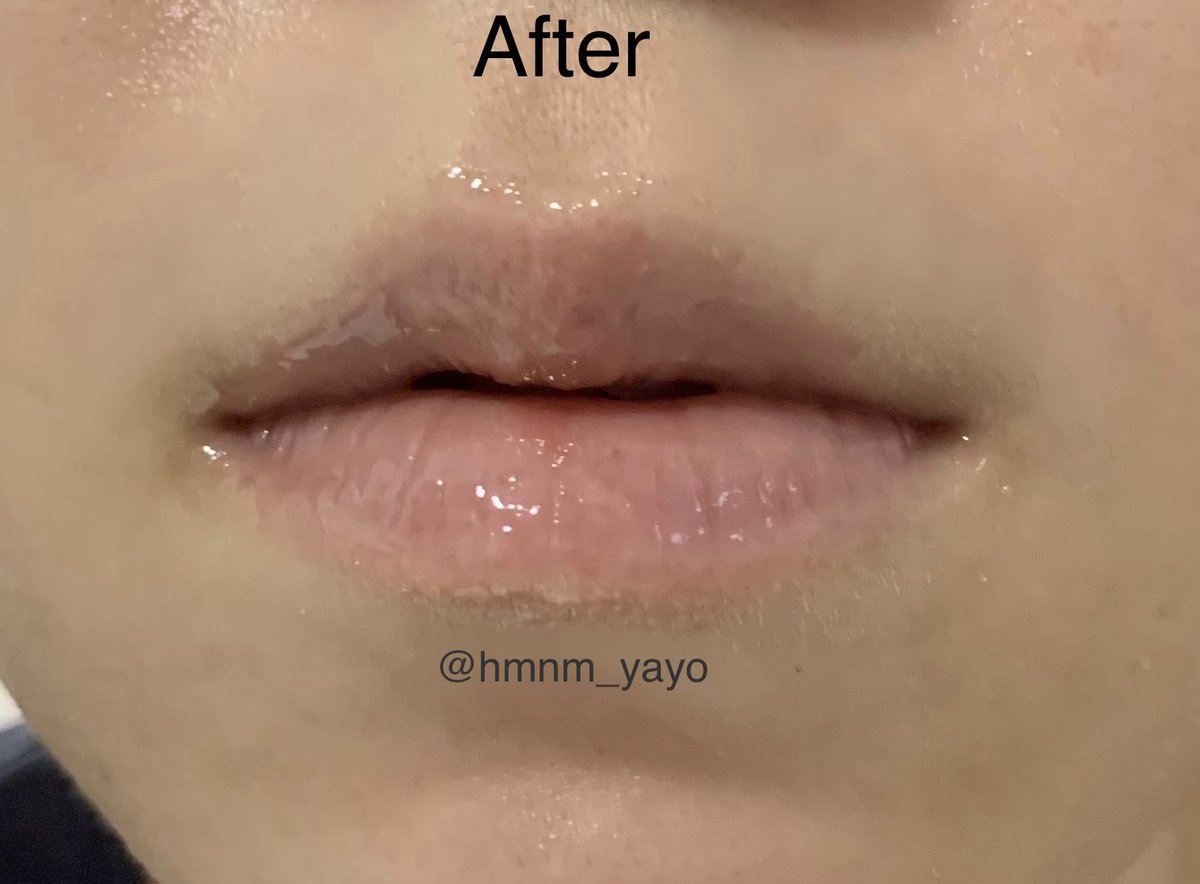 #제품제공 #체험단 <a href="/fully_official_/">풀리</a> 

풀리 레드토마토 젤리 립 마스크 &amp; 그린토마토 스무디 립 스크럽 사용 후기 타래🍅

요즘 추운 날씨 때문에 입술이 너무 사막처럼 바삭바삭 건조하고 매일 각질 쌓였는데 저자극으로 립 케어 할 수 있어서 좋았어요👍