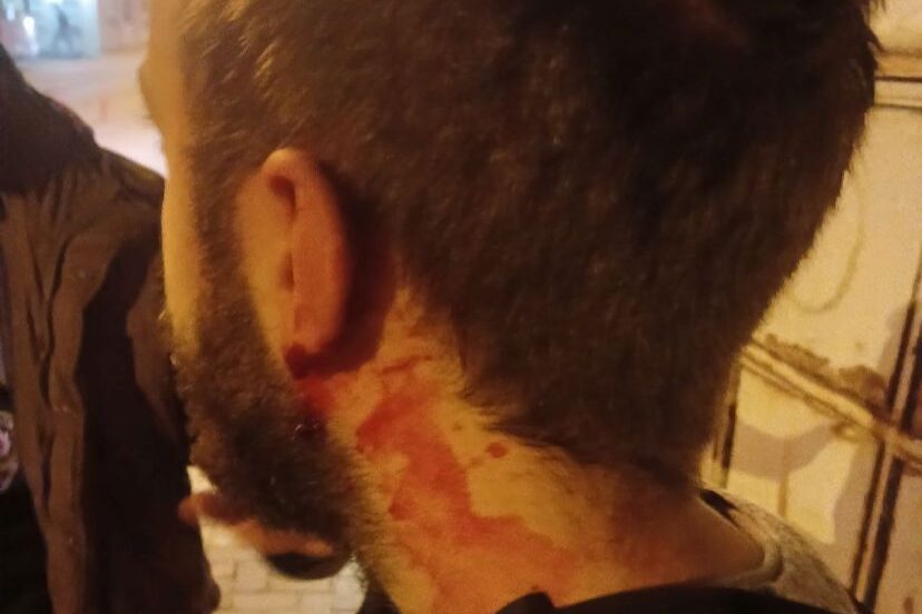 Bartın’da üniversitelilere faşist saldırı 

sendika.org/2025/11/bartin…