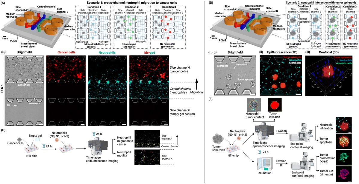 uFluidix's tweet image. New on our Research Highlight of the Week! Scientists built a “tumor-on-a-chip” to study how neutrophils can both fight and support cancer. N1 cells slow tumor growth, while N2 cells drive invasion. Read more 👇 ufluidix.com/blog/mapping-t…
#Microfluidics #CancerImmunology #LabonaChip