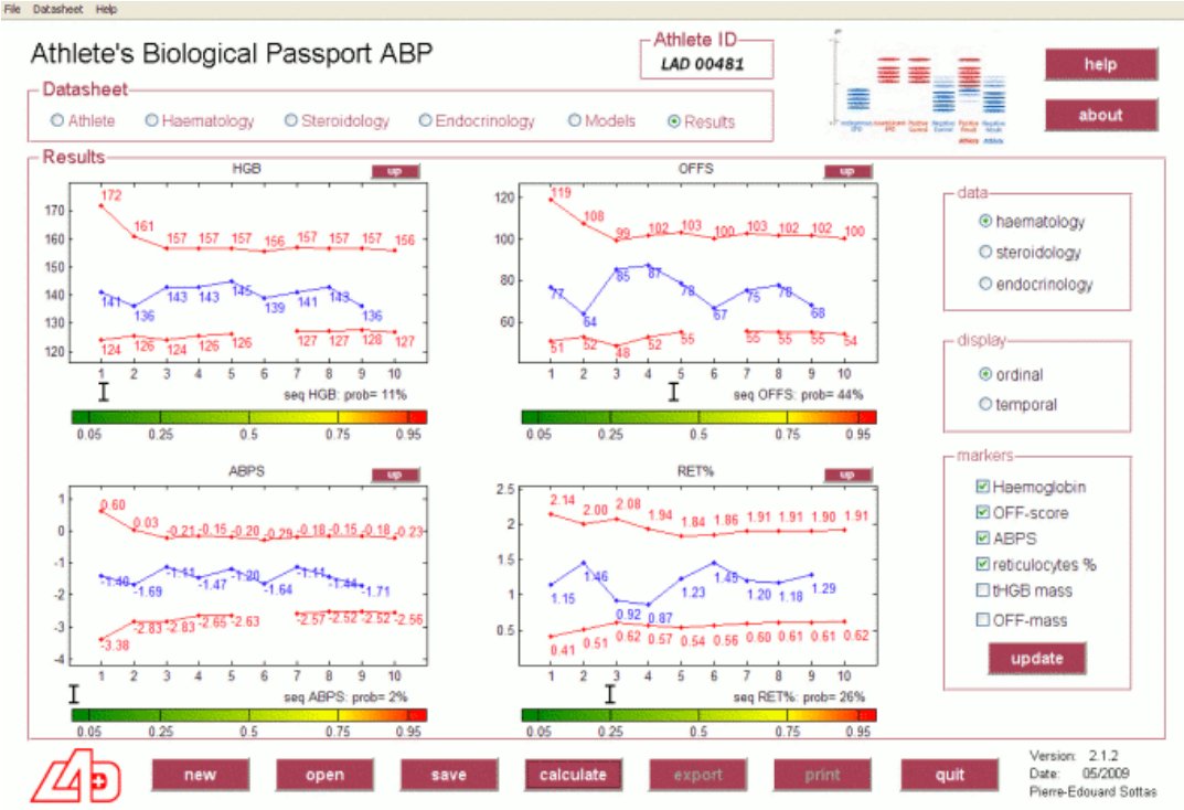 #Dopage 💉 / Le processus est lent : l’UCI prend son temps pour éviter toute faille procédurale. Lazkano reste présumé innocent, bien que suspendu, mais l’UCI n’a jamais perdu un tel dossier. Le passeport biologique piège les coureurs, jamais leur entourage. 

📎 Lien de l'édito