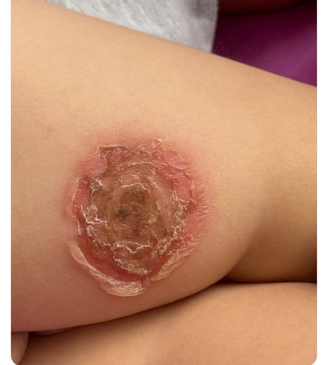 IhabFathiSulima's tweet image. What is the diagnosis?