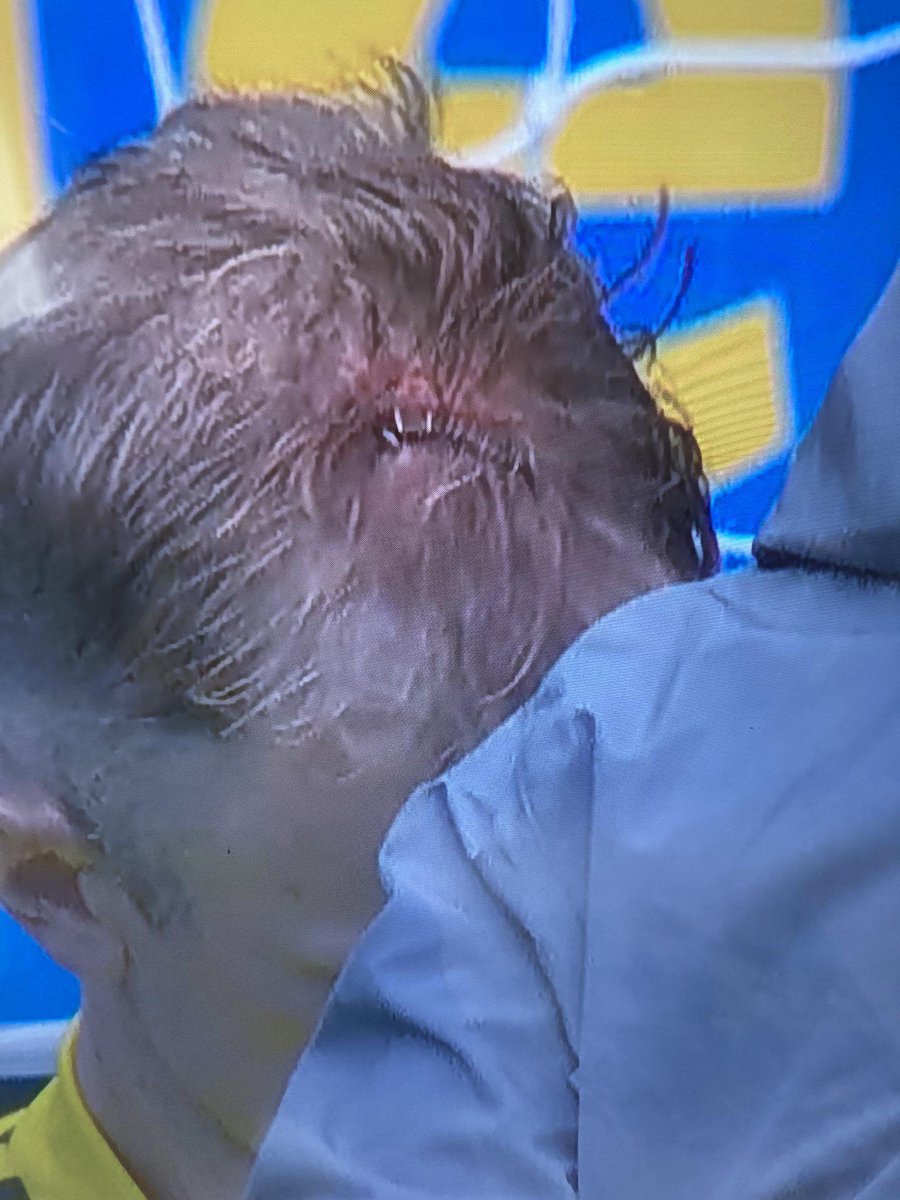 Sean_Down_Under's tweet photo. VAR official from Sunday was Steven McLean. He was referee when he deemed this a yellow card in 2022 and no-one questioned it. https://t.co/oEmpns3ykv