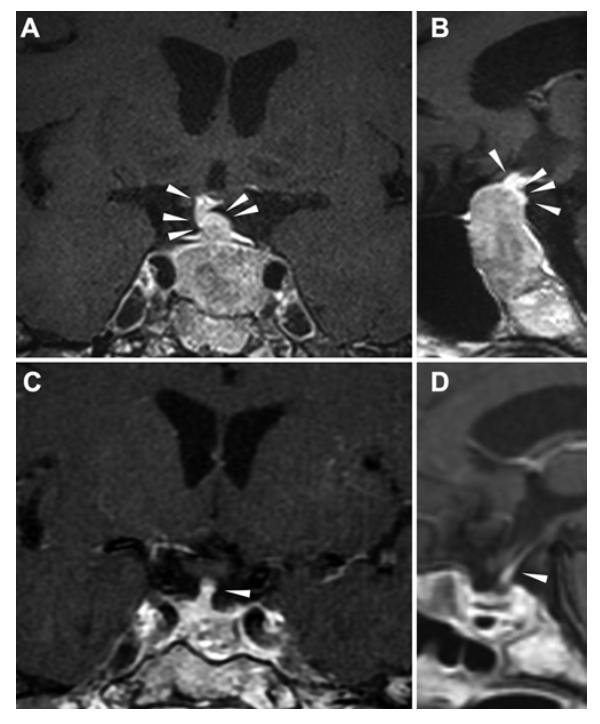 Journal of Neurosurgery tweet media