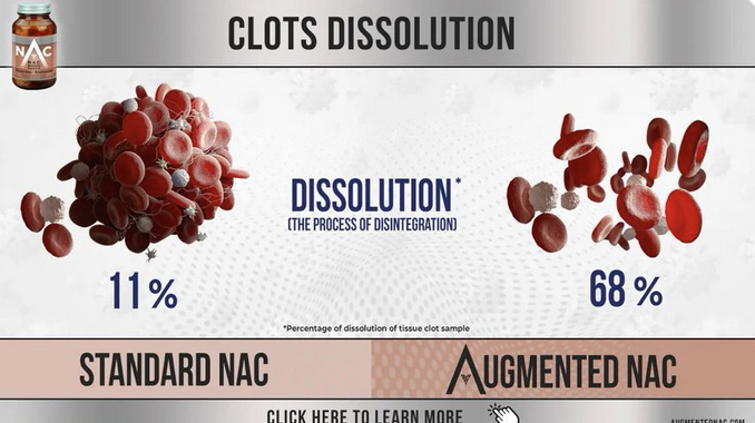 Besides lab studies showing of denature of spike protein, Augmented NAC also dissolved blood clots.