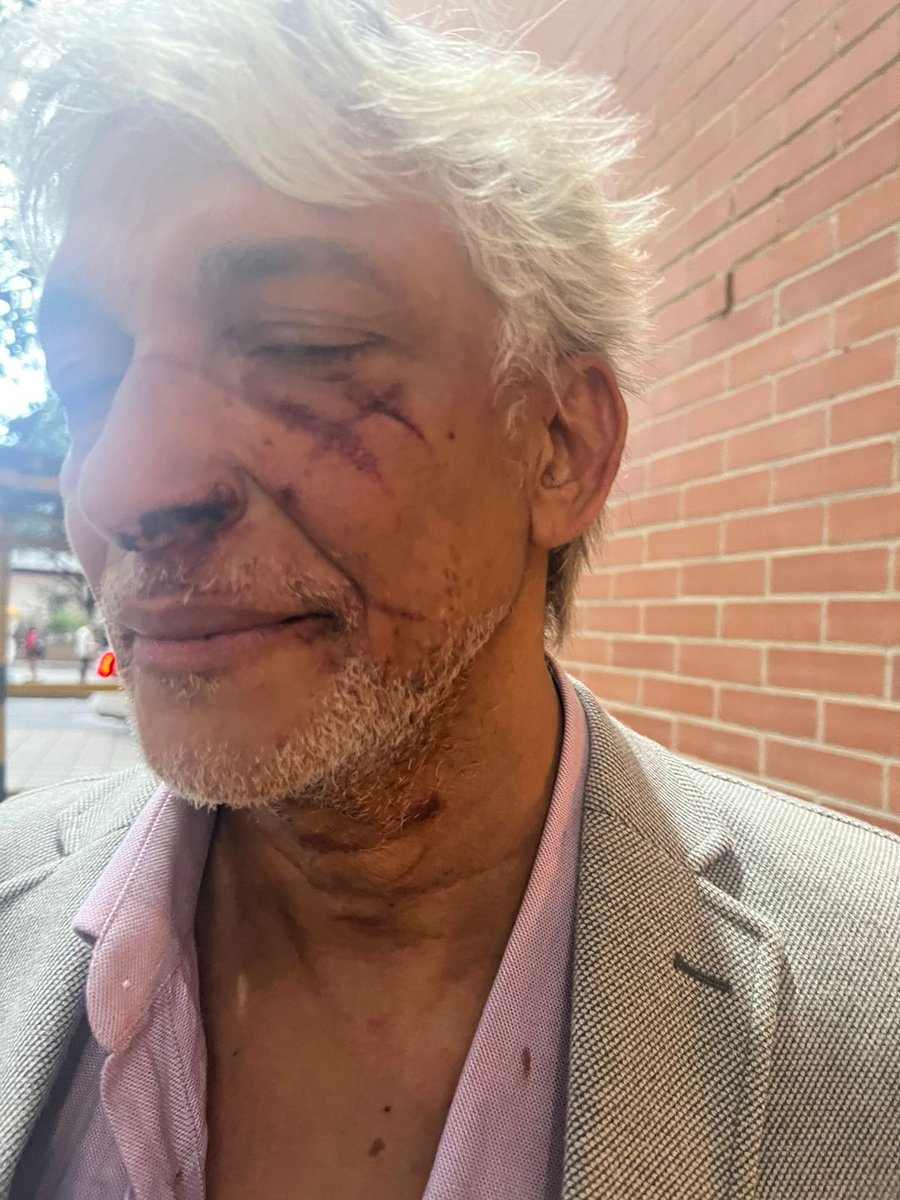 CESARANDBARROS's tweet image. #CristobalPTeApoyamos   
#CreoEnCristoPadilla
No quiero hacer honor a la violencia, pero tampoco puede ser usada para fines políticos y en detrimento de las personas. Creo en Cristóbal. Miren las fotos y vídeos. La Sra que se declara víctima, no está golpeada.