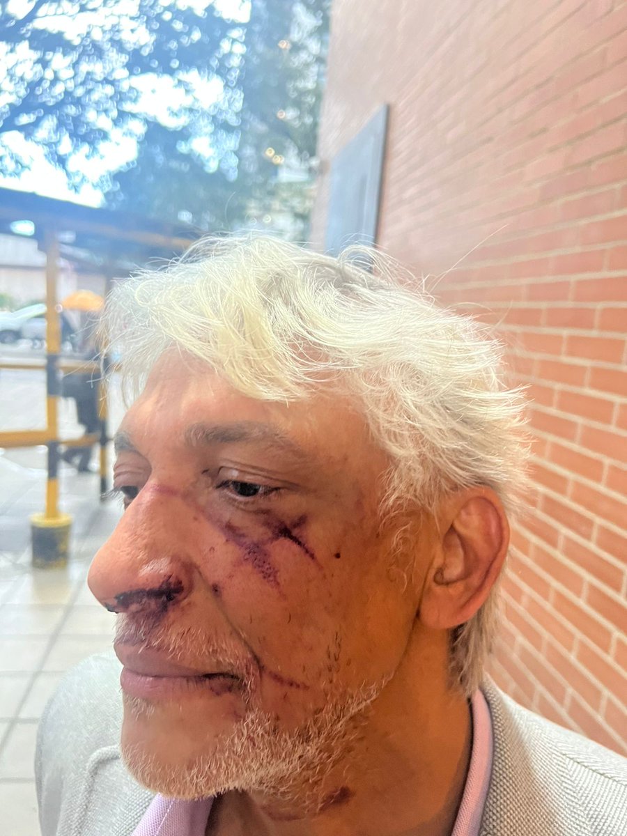 CESARANDBARROS's tweet image. #CristobalPTeApoyamos   
#CreoEnCristoPadilla
No quiero hacer honor a la violencia, pero tampoco puede ser usada para fines políticos y en detrimento de las personas. Creo en Cristóbal. Miren las fotos y vídeos. La Sra que se declara víctima, no está golpeada.