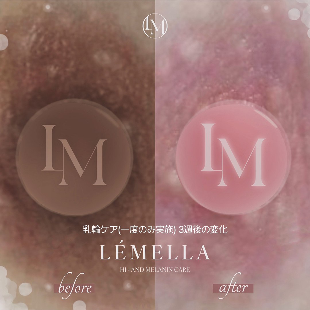 韓国公式】ルメラ (@lemella_jp) / Posts / X