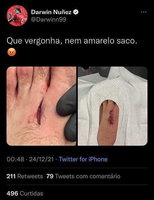 Relativamente a pisões, estamos conversados…