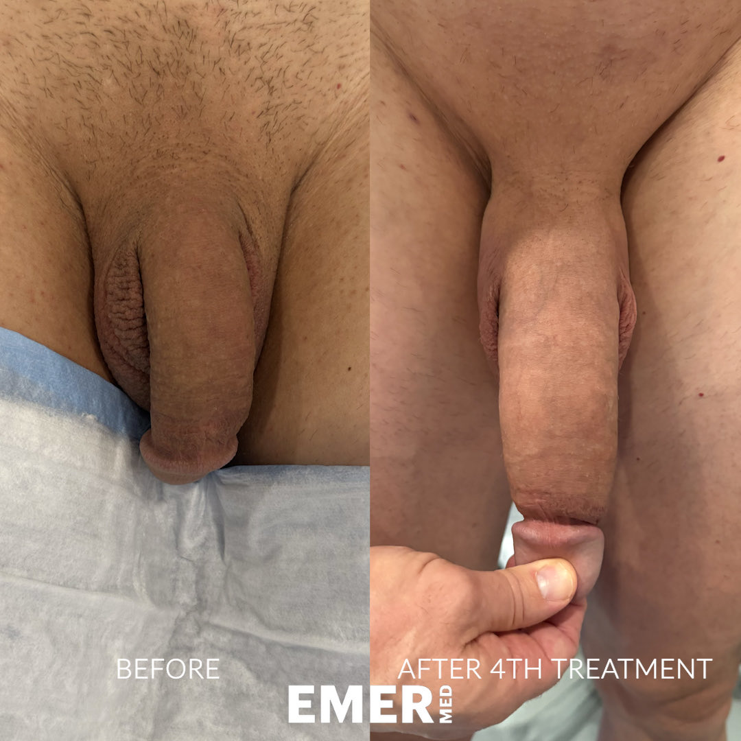 Dr. Jason Emer tweet media