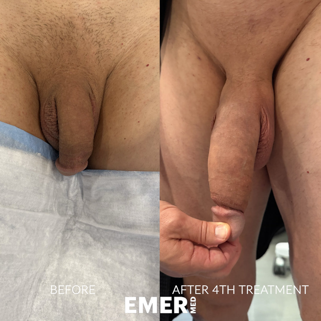 Dr. Jason Emer tweet media