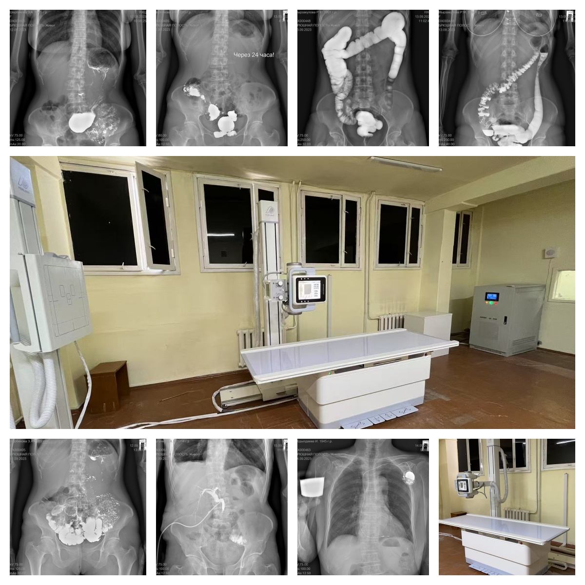 PerloveMedical's tweet photo. 3 Years of Trust, Proven Quality!
Perlove Medical’s dual-FPD DR system has served the National Surgical Center in Kyrgyzstan with clear imaging, smooth operation, and lasting reliability. 💪
#PerloveMedical #DRSystem #HealthcareInnovation #Kyrgyzstan https://t.co/vwdhgM5SwV