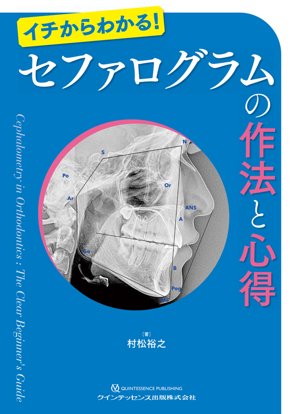 ※バラ売り不可裁断Journal of Aligner Orthodontics アライナー矯正のリカバリーテクニック 裁断済 インビザライン