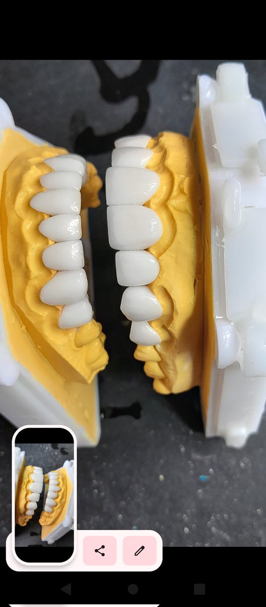 SunSmile_Lab's tweet image. #răng sứ thẩm mỹ 🥳