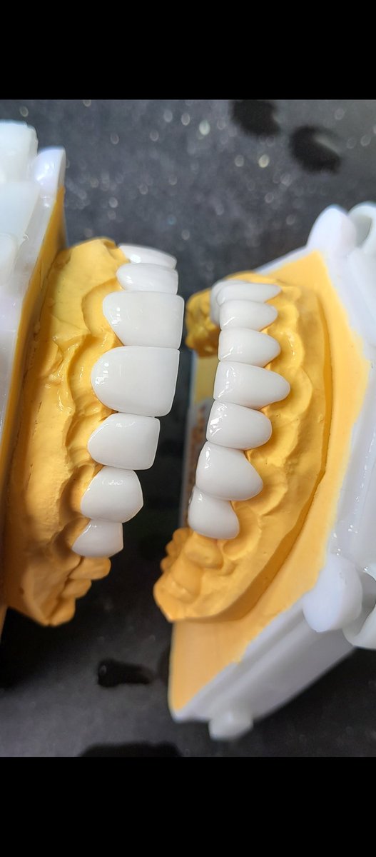 SunSmile_Lab's tweet image. #răng sứ thẩm mỹ 🥳