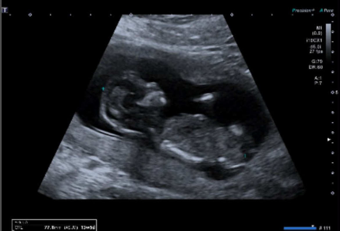 Front Recapzz tweet media