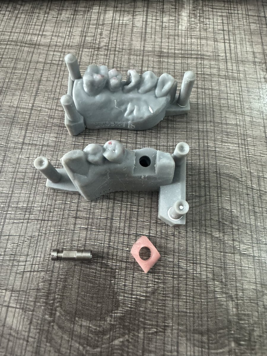 custom abutment, resin model, gingival mask and analog. 
— full digital case