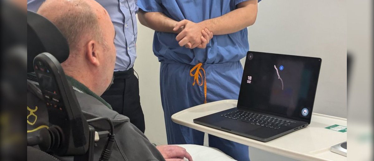 🇬🇧 NEURALINK: FIRST UK PATIENT USES THOUGHT TO CONTROL COMPUTER HOURS AFTER IMPLANT

A man with motor neuron disease has become the first person in the UK to control a computer using only his thoughts, just hours after receiving a Neuralink brain implant.

The procedure, led by
