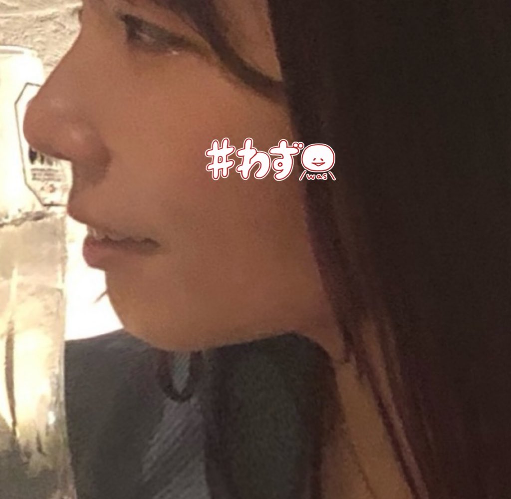 プチ矯正のススメ! プチ矯正のススメ| 歯科総合出版社 デンタル