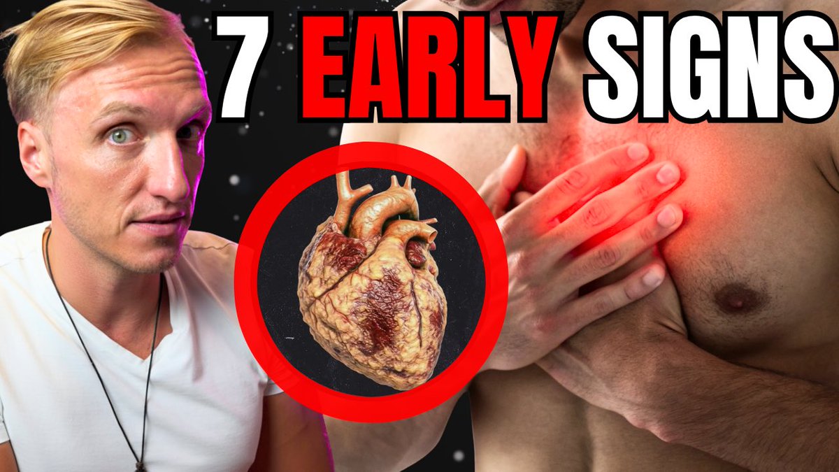 ChrisMMHealth's tweet image. 7 Early Warning Signs of Heart Attack! [prevent NOW]

👉 youtu.be/jVyQlKHBAJw (click)