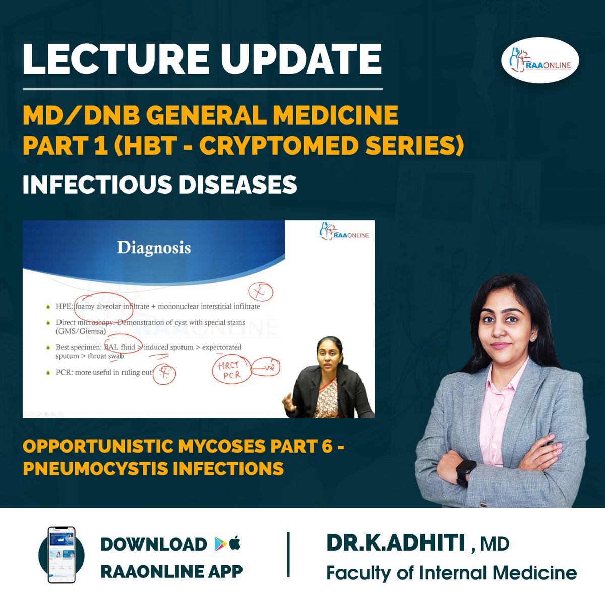 Raaonline's tweet image. Lecture Update in General Medicine - Opportunistic Mycoses Part 6 - Pneumocystis Infections by Dr. K. Adhiti on RAAONLINE App. 
Android: play.google.com/store/apps/det… 
IOS: apps.apple.com/in/app/raaonli…
Contact: +91-9994994266
#raaonline #freelecture #Mycoses #pneumocystisinfections