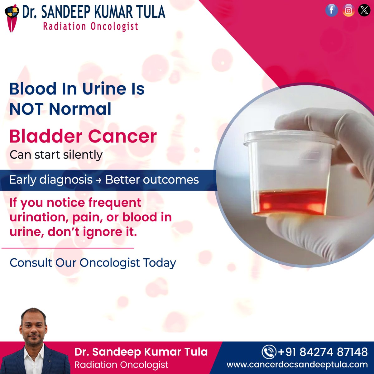 Blood in Urine Is NOT Normal!
Bladder Cancer can start silently — early diagnosis ensures better outcomes.
For more visit :
cancerdocsandeeptula.com

#DrSandeepKumarTula #RadiationOncologist #YashodaHospital #Secunderabad #RadiationOncologistHyderabad #CancerSpecialistSecunderabad