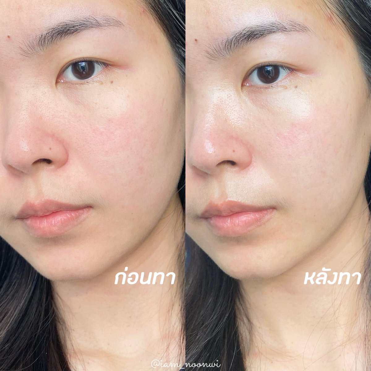 iam_noonwi's tweet photo. ช่วงผิวอ่อนแอ แห้ง ลอก คือได้ #Purito ช่วยไว้จริงๆ💚 ตัวนี้มี Panthenol10% ช่วยปลอบประโลม ลดการระคายเคือง และช่วยเสริม Skin Barrierให้ผิว เนื้อครีมกึ่งเจล ทาแล้วผิวชุ่มชื้น ซึมง่าย ไม่เหนอะ ไม่มีน้ำหอม ไม่มีแอลกอฮอล์ เหมาะกับคนผิวแพ้ง่ายมากๆ✨
#ผิวแพ้ง่ายใช้ได้ #ใช้ดีบอกต่อ https://t.co/7EXKsfpzdI