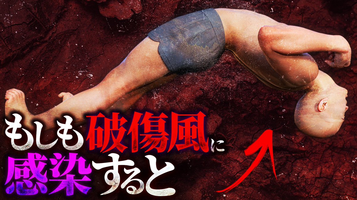【衝撃】破傷風に感染した者の末路... 

youtu.be/zYcPzapbFGM?si…