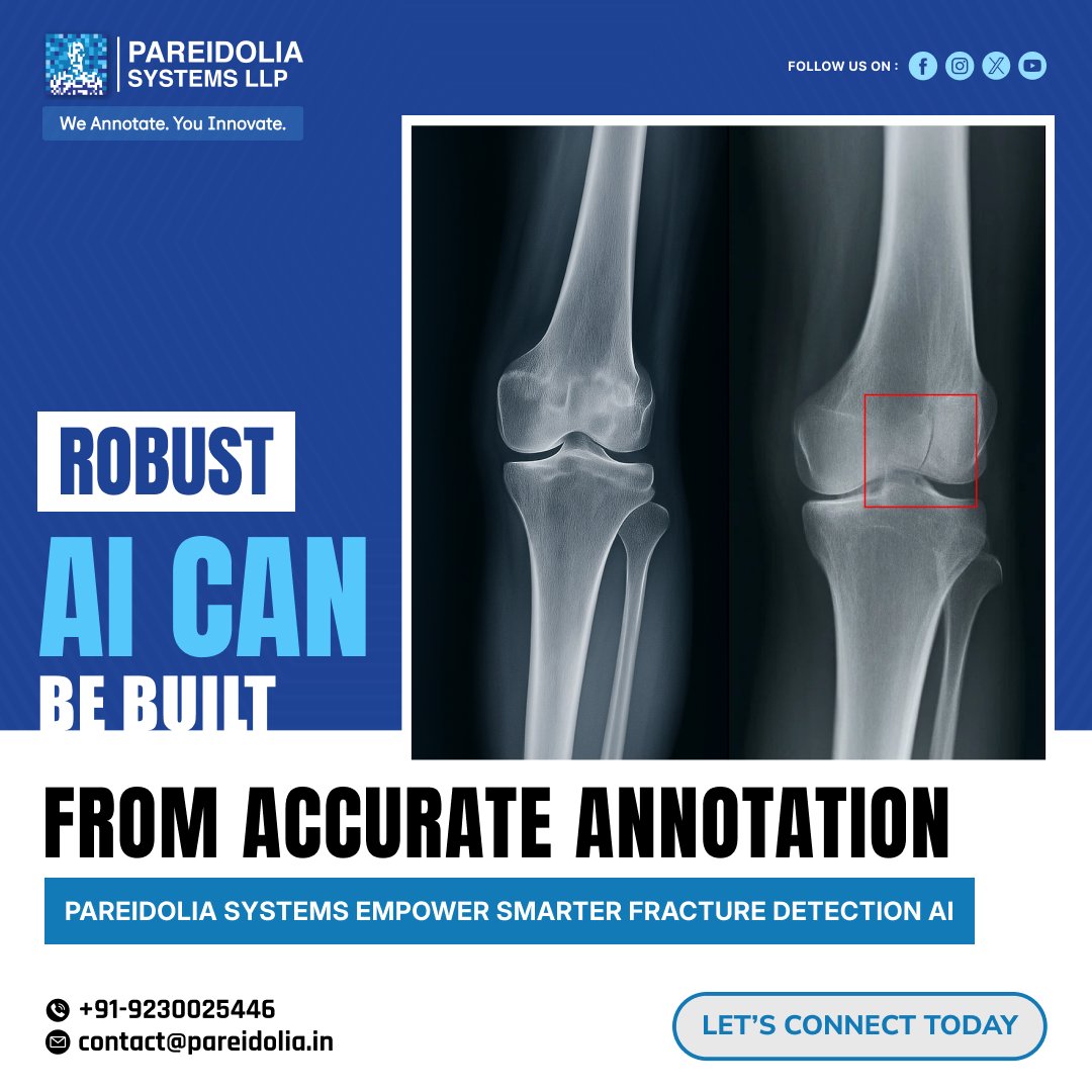 pareidoliallp's tweet image. 🩺 𝐑𝐨𝐛𝐮𝐬𝐭 𝐀𝐈 𝐛𝐞𝐠𝐢𝐧𝐬 𝐰𝐢𝐭𝐡 𝐀𝐜𝐜𝐮𝐫𝐚𝐭𝐞 𝐀𝐧𝐧𝐨𝐭𝐚𝐭𝐢𝐨𝐧.
💡 Every accurate annotation moves AI closer to clinical excellence.
𝗪𝗲 𝗔𝗻𝗻𝗼𝘁𝗮𝘁𝗲. 𝗬𝗼𝘂 𝗜𝗻𝗻𝗼𝘃𝗮𝘁𝗲.

📧contact@pareidolia.in
🌐pareidolia.in

#cancerdetection