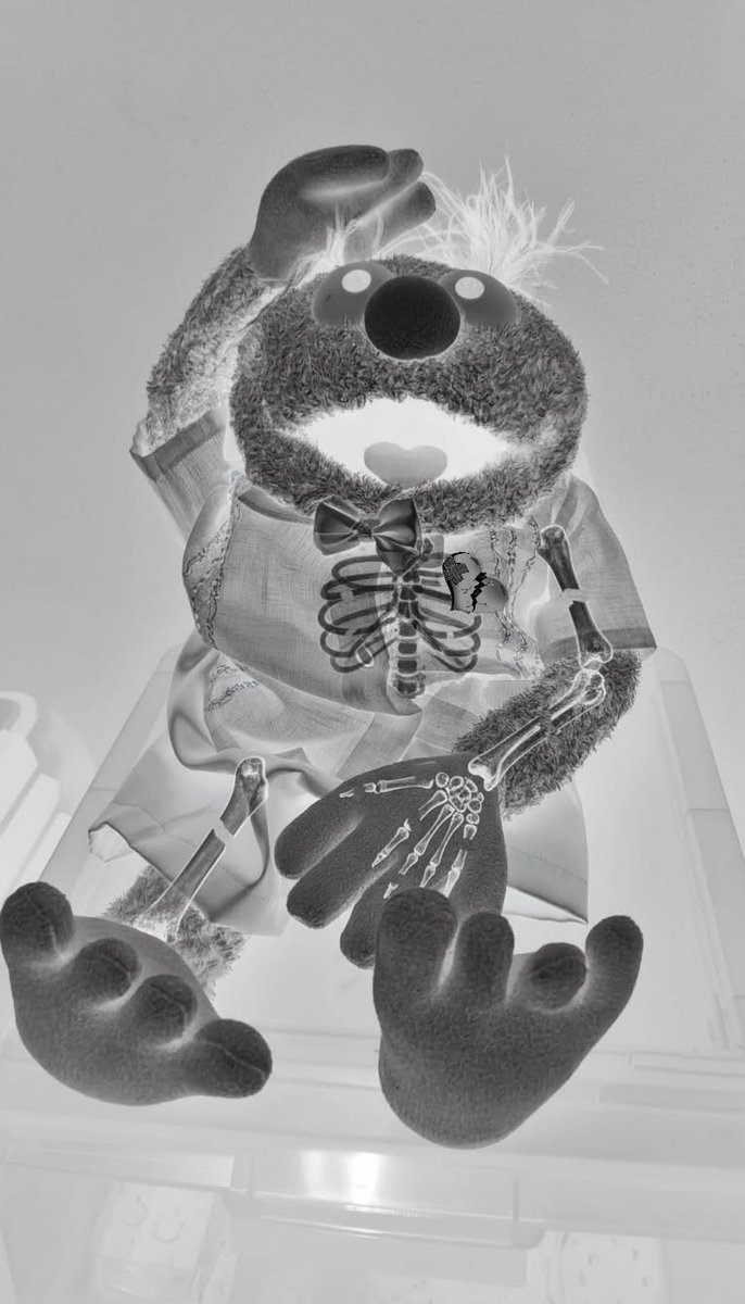 *GRAPHIC WARNING*

<a href="/binbindxcn/">Binbin</a>'s XRAY has come out and has the following impressions
- Right Leg Complete Fracture
- Multiple fractures left arm
- Multiple fractures on ribs
- A Broken Heart ☹️

Help him recover quickly by answering this survey below!!
forms.gle/wuzw5zJ7EExixA…