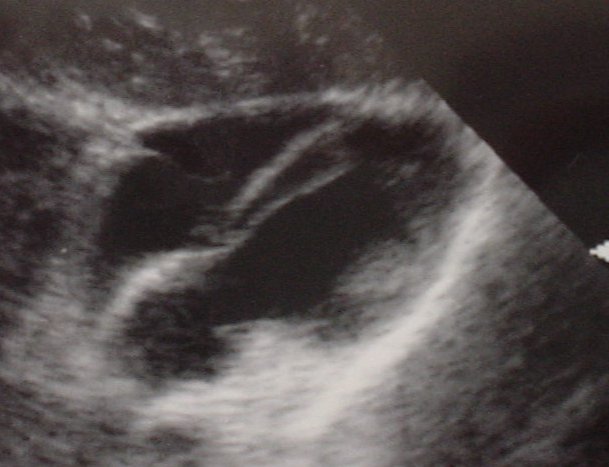 Emergency Medicine Case Challenge of the week: Cyanotic
erpocketbooks.com/us6-2/