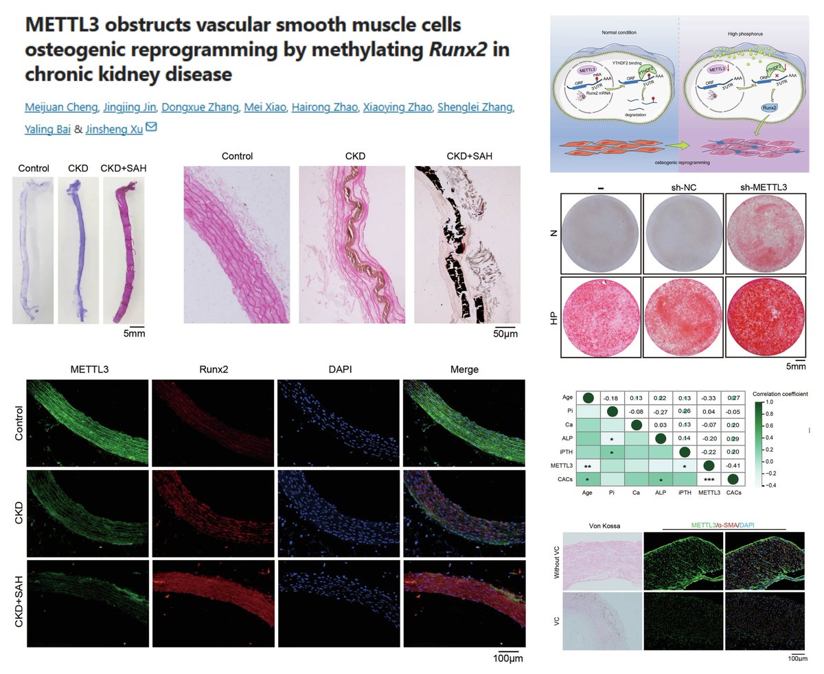 HaoYin20's tweet image. #VascularCalcification #SmoothMuscleCell m6A Epitranscriptomics

High Pi ⏬METTL3 in SMCs

METTL3-YTHDF2 destabilizes RUNX2 mRNA &amp;amp; ⏬ SMC Osteogenesis

S-Adenosylhomocysteine as METTL3/14i aggravates aortic calcification in CKD 🐭 (adenine + hi Pi diet)

@CommsBio 2025…