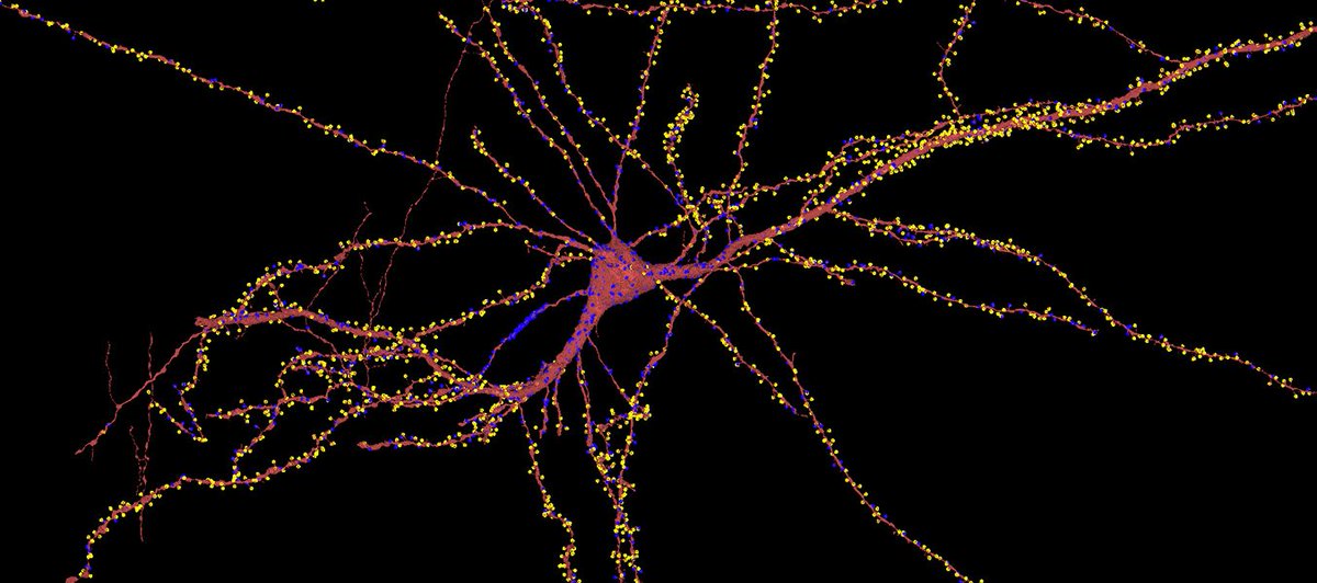 Neuroplasticity doesn't have an expiry date.

Go learn that new thing today.

This is a single neuron with countless connections.