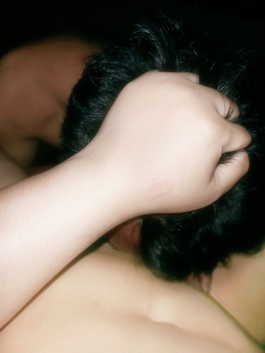 รับตรวจสุขภาพหนังศีรษะ #นิคม304